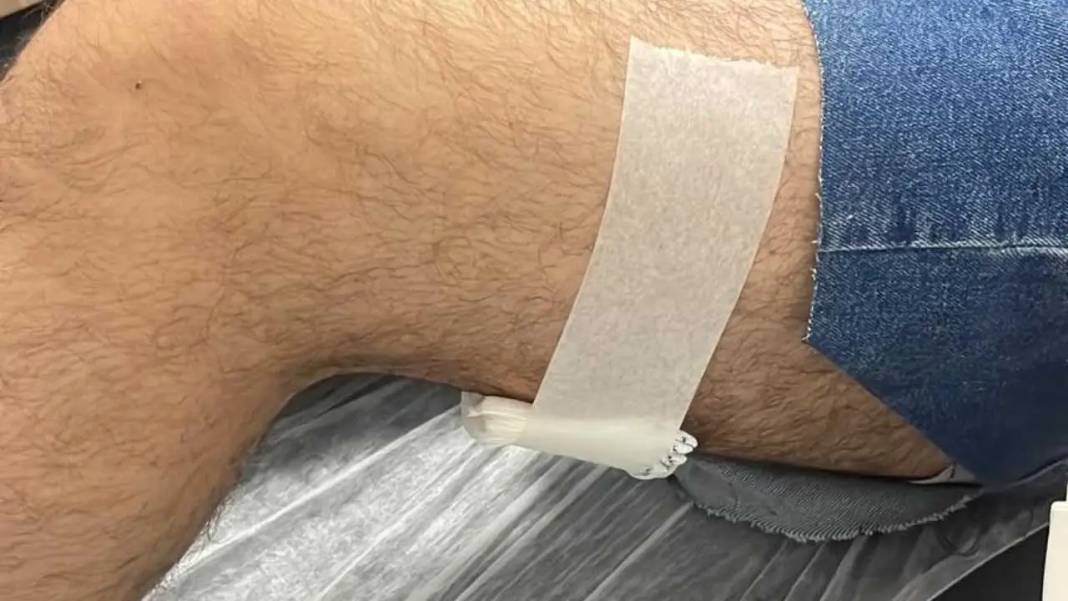 Adana’da Üç Lise Öğrencisinin Bıçaklandığı Olayda Neler Yaşandı? 5